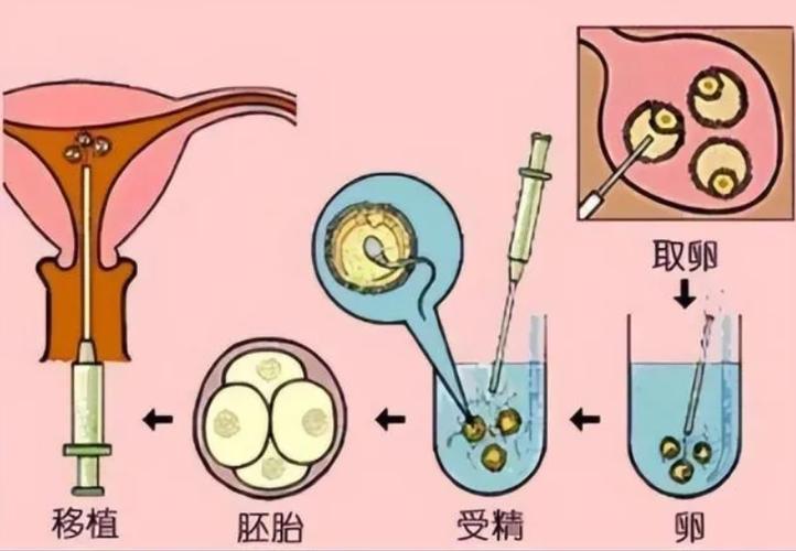 供卵方可以要回孩子吗(供卵方是否有权要回孩子?)